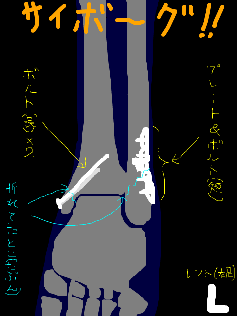 レントゲン模写！