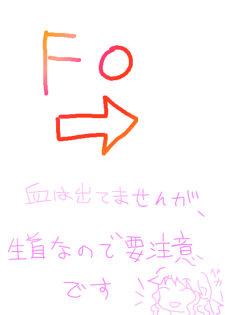 FO注意